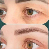آفر ویژه عمل بینی پلک/کاشت مو/دندان/غبغب/لیپوابدو|خدمات آرایشگری و زیبایی|شیراز, معالی‌آباد|دیوار