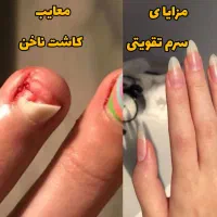 سرم تقویت ناخن اصل نمایندگی بردسیر|آرایشی، بهداشتی، درمانی|بردسیر, |دیوار