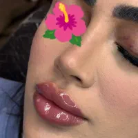 جشنواره ژل و بوتاکس سی سی 1میلیون خانم و اقایون