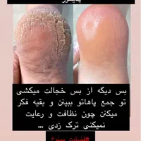 خدمات پودولوژی و پدیکور درمانی ، تخلیه میخچه و ..|خدمات آرایشگری و زیبایی|تهران, فردوس|دیوار