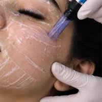 پوست کره ای و فیشیال انواع خدمات پوستی