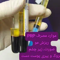 لب روسی، لیفت، جوانسازی، بوتاکس زیر بغل  توسط پزشک|خدمات آرایشگری و زیبایی|کرج, فاز ۵ مهرشهر|دیوار