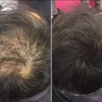 خداحافظی با ریزش مو در یک دوره ۱۰۰٪ گیاهی و تضمینی|آرایشی، بهداشتی، درمانی|مشهد, راهنمایی|دیوار
