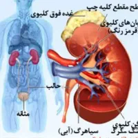 بهبود مشکلات کلیه
