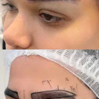 کاشت ابرو با تخفیف تکرار نشدنی