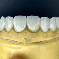 کامپوزیت.لمینت|خدمات آرایشگری و زیبایی|تهران, هفت حوض|دیوار