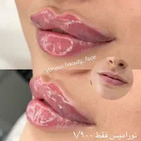 لیزر لک کلینیک تزریق ژل390فیلر بوتاکس هایفو کانتور