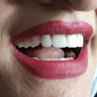 دندانسازی نیک دنتال