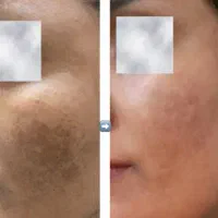 فرصت محدود|آرایشی، بهداشتی، درمانی|مسجد سلیمان, |دیوار