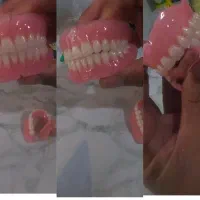 ساخت تخصصی دندان مصنوعی بابیش از 25سال تجربه کاری