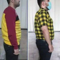 چربی سوزی شکم پهلو|آرایشی، بهداشتی، درمانی|گناباد, |دیوار