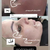 فیشال داخل کیلینیک وسالن زیبایی|خدمات آرایشگری و زیبایی|قم, صدوق|دیوار