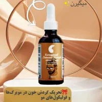 رفع ریزش مو