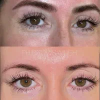 میکروبلیدینگ ابرو|خدمات آرایشگری و زیبایی|تهران, جمال‌زاده|دیوار