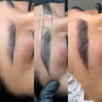 اموزش و اجرا فیبروز میکروبلدینگ