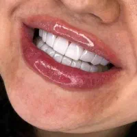 دندان پزشکی/جشنواره کامپوزیت 16واحد دوفک 20م
