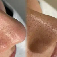 خدمات فشیال تخصصی خانوم وآقا|خدمات آرایشگری و زیبایی|سنندج, |دیوار