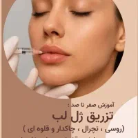 آموزش لاین ژل و بوتاکس