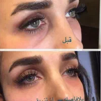 کلینیک تخصصی زیبایی/بوتاکس فیلر لاغری مزو PRP|خدمات آرایشگری و زیبایی|رفسنجان, |دیوار