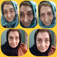 جوانی و زیبایی ،ارمغان مطب ما است|استخدام درمانی، زیبایی، بهداشتی|تهران, حمزهآباد|دیوار