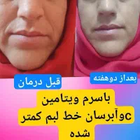 سرم ویتامین Cآریا|آرایشی، بهداشتی، درمانی|تهران, محمودیه|دیوار