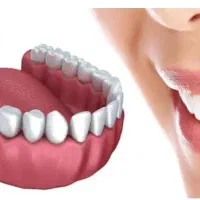 ایمپلنت با کیفیت و تعرفه دولتی|خدمات آرایشگری و زیبایی|رشت, دیلمان|دیوار