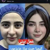 عمل بینی/متخصص گوش وحلق و بینی/دکتر علیرضا بختیاری