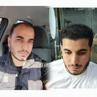کاشت مو طبیعی شیراز|خدمات آرایشگری و زیبایی|شیراز, قصرالدشت|دیوار