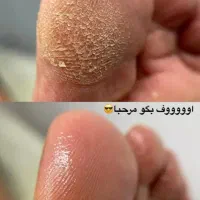 مدل برای پدیکور تضمینی