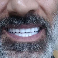 جشنواره مرکزدست دندان وساخت دندانهای مصنوعی ژله‌ای