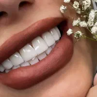 کامپوزیت ونیر|خدمات آرایشگری و زیبایی|قم, سالاریه|دیوار