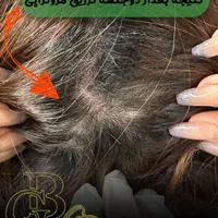 فیشیال.کربن.لیزر.لاغری.هایفو|خدمات آرایشگری و زیبایی|کرج, کوی زنبق|دیوار
