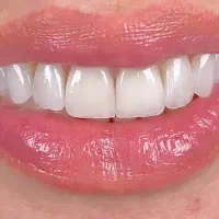 خدمات دندانپزشکی|خدمات آرایشگری و زیبایی|پارسآباد, |دیوار