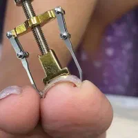 ارتونیل شصت پا