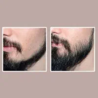 معجزه گیاهی|آرایشی، بهداشتی، درمانی|رشت, پارک شهر|دیوار