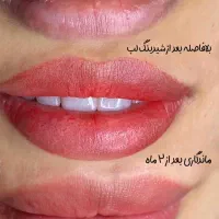 بوتاکس،میکرو،شیدینگ تخفیف ویژه|خدمات آرایشگری و زیبایی|بیرجند, |دیوار