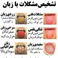 تشخیص مشکلات بدن از روی زبان