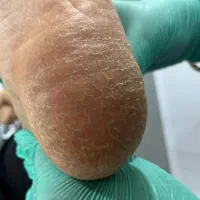 تخفیف ویژه یلدایی خدمات کاشت ناخن و اسپا|خدمات آرایشگری و زیبایی|بندر گناوه, |دیوار