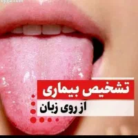 تشخیص بیماری از روی زبان