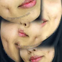 پیرسینگ گوش ،بینی،لب،میکرودرمال،چالگونه|خدمات آرایشگری و زیبایی|قم, شهرک فاطمیه|دیوار