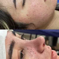 جراحی.بینی.دماغ. دراهواز۲۵ت فقط تااخرهفته