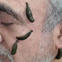 فروش زالو در سایزهای مختلف|آرایشی، بهداشتی، درمانی|کرج, استاندارد|دیوار