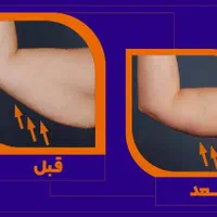 لاغری موضعی بدون جراحی و رژیم سخت|خدمات آرایشگری و زیبایی|اصفهان, سعادت‌آباد|دیوار