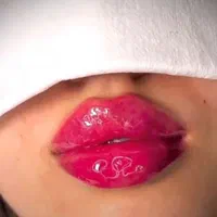 جشنواره تزریق ژل بوتاکس فیلر پی آرپی مطب زیبایی|خدمات آرایشگری و زیبایی|تبریز, |دیوار