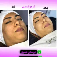 تخفیف پاییزه فیشال کلاسیک|خدمات آرایشگری و زیبایی|دوگنبدان, |دیوار