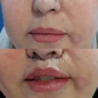 خدمات پوست و زیبایی|خدمات آرایشگری و زیبایی|شیراز, چوگیاه‎|دیوار