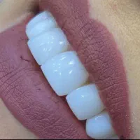 دندانسازی تخصصی دنیز