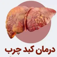 درمان کبدچرب