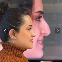 فرصت عالی جراحی بینی در تهران