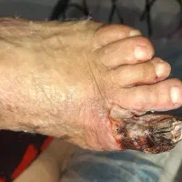 کارشناس و درمانگر زخم ،خدمات پرستاری در منزل|خدمات آرایشگری و زیبایی|برازجان, |دیوار